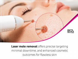 Electric plasma pen skin mole removal, Well Mart, 03208727951